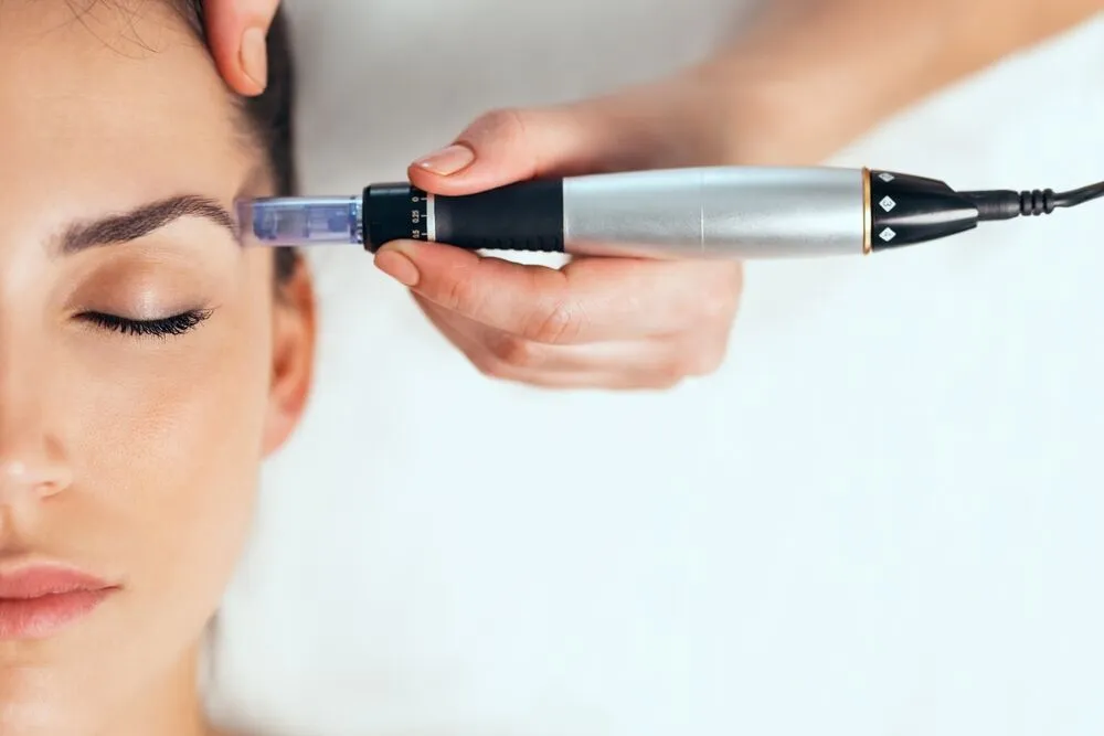 Learn More About Microneedling